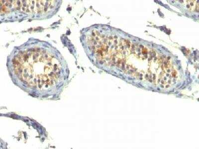 Immunohistochemistry-Paraffin: TGF-alpha Antibody (P/T1) - Azide and BSA Free [NBP2-34702]