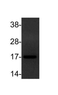 Western Blot: TGF-alpha Antibody (SPM542)Azide and BSA Free [NBP2-34418]