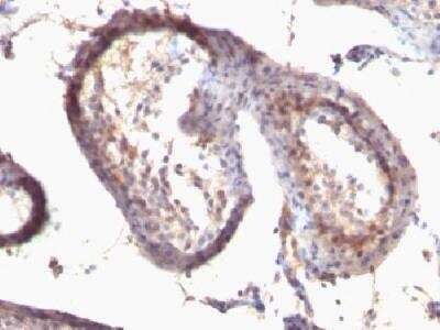 Immunohistochemistry-Paraffin: TGF-alpha Antibody (SPM542) [NBP2-34371]