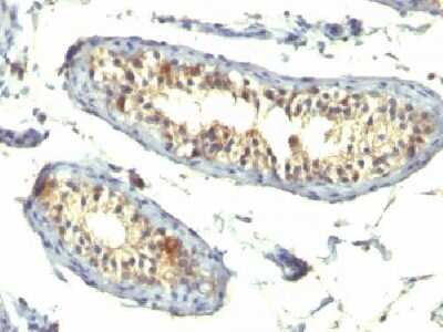 Immunohistochemistry-Paraffin: TGF-alpha Antibody (TG86 + P/T1) - Azide and BSA Free [NBP2-34723]