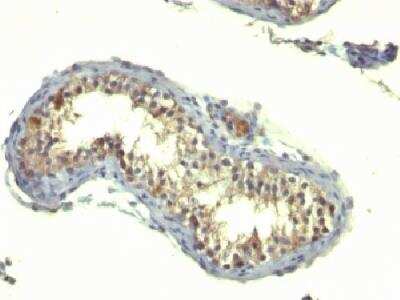 Immunohistochemistry-Paraffin: TGF-alpha Antibody (TG86) - Azide and BSA Free [NBP2-34722]