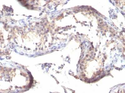 Immunohistochemistry-Paraffin: TGF-alpha Antibody (TGFA/1119) [NBP2-45142]