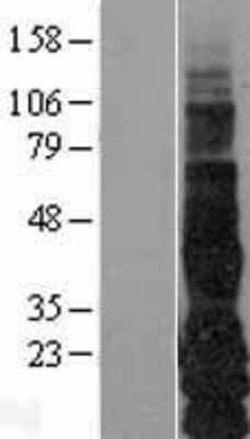 Western Blot: TGF-alpha Overexpression Lysate [NBL1-16851]