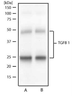 Western Blot: LAP (TGF-beta 1) Antibody (7F6)BSA Free [NBP2-22114]