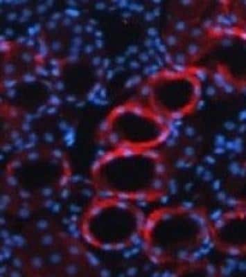 Immunocytochemistry/ Immunofluorescence: TGF-beta 1 Antibody [NBP1-80289]