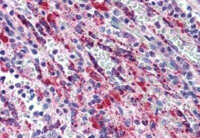 Immunohistochemistry-Paraffin: TGF-beta 1 Antibody [NBP1-03276]
