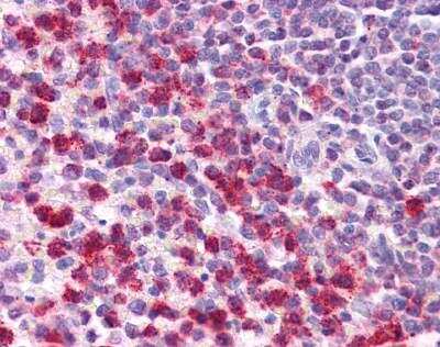 Immunohistochemistry-Paraffin: TGF-beta 1 Antibody [NBP1-80289]