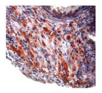 Immunohistochemistry-Paraffin: TGF-beta 1 Antibody [NBP1-80289]