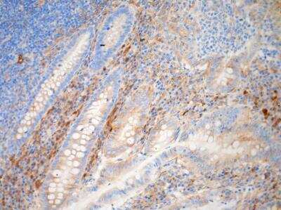 Immunohistochemistry-Paraffin: TGF-beta 1 Antibody [NBP1-80289]