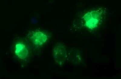 Immunofluorescence: TGF-beta 1 Antibody (OTI1E12) [NBP2-46108]