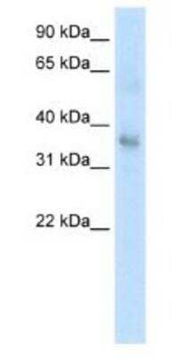 Western Blot: TGF-beta 1 Antibody [NBP1-80289]