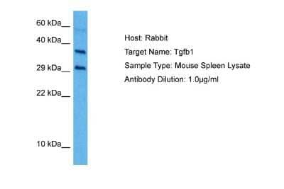 Western Blot: TGF-beta 1 Antibody [NBP1-80289]