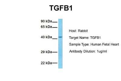 Western Blot: TGF-beta 1 Antibody [NBP1-80289]