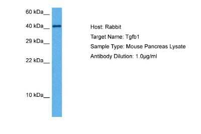 Western Blot: TGF-beta 1 Antibody [NBP1-80289]