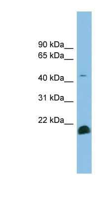 Western Blot: TGF-beta 2 Antibody [NBP1-59437]