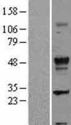 Western Blot: TGF-beta 2 Overexpression Lysate [NBL1-16854]