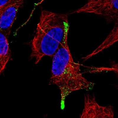 Immunocytochemistry/ Immunofluorescence: TGF-beta 3 Antibody [NBP2-57259]