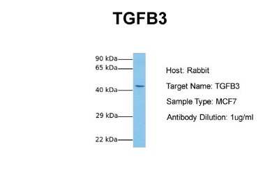 Western Blot: TGF-beta 3 Antibody [NBP1-58287]