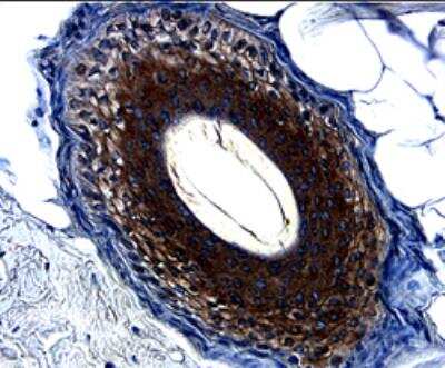 Immunohistochemistry: TGF-beta Antibody (1D11.16.8) - Azide and BSA Free [NBP2-47736]