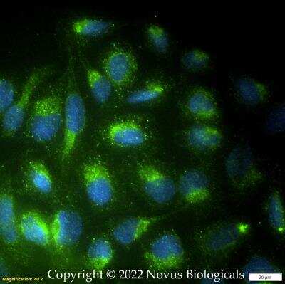 Immunocytochemistry/ Immunofluorescence: TGF-beta Antibody (1D11.16.8) - BSA Free [NBP2-45137]