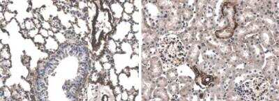 Immunohistochemistry-Paraffin: TGF-beta RI/ALK-5 Antibody (RM0016-3A11) - Azide and BSA Free [NBP2-11921]