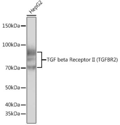 Western Blot: TGF-beta RII Antibody (2M8Y2) [NBP3-15679]