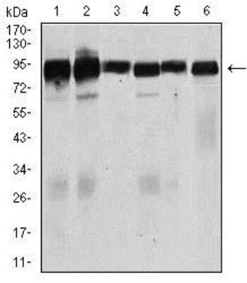 Western Blot: TGF-beta RIII Antibody (1C5H11)BSA Free [NBP2-37418]