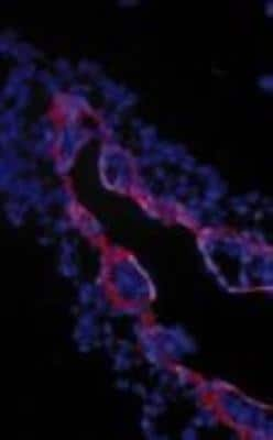 Immunohistochemistry: TGF-beta RIII Antibody [NBP2-66592]