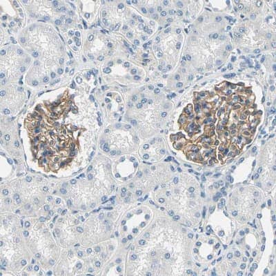 Immunohistochemistry-Paraffin: TGF-beta RIII Antibody [NBP1-89988]