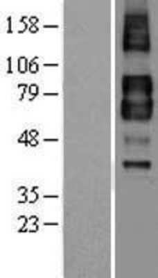 Western Blot: TGF-beta RII Overexpression Lysate [NBL1-16857]