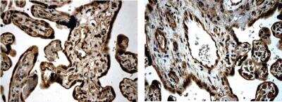 Immunohistochemistry-Paraffin: TGF-beta RIII Antibody (MM0057-5G9) - Azide and BSA Free [NBP2-11920]