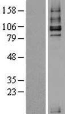 Western Blot: TGF-beta RIII Overexpression Lysate [NBL1-16858]