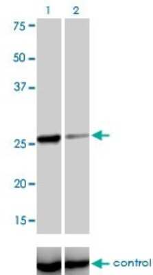 Western Blot: TGF beta induced factor 2 Antibody (4C10) [H00060436-M01]