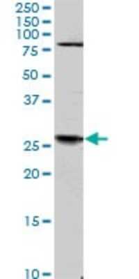 Western Blot: TGF beta induced factor 2 Antibody (4C10) [H00060436-M01]
