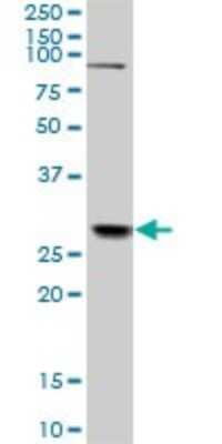 Western Blot: TGF beta induced factor 2 Antibody (4C10) [H00060436-M01]