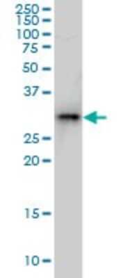 Western Blot: TGF beta induced factor 2 Antibody (4C10) [H00060436-M01]