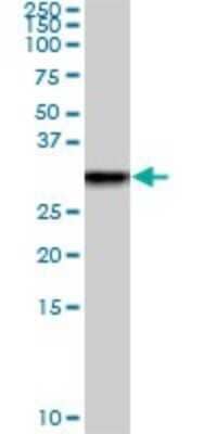 Western Blot: TGF beta induced factor 2 Antibody (4C10) [H00060436-M01]