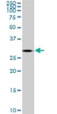 Western Blot: TGF beta induced factor 2 Antibody (4C10) [H00060436-M01]