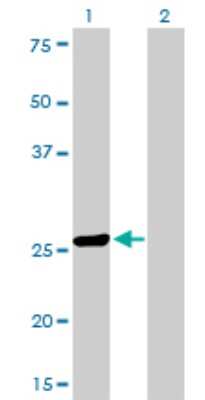Western Blot: TGF beta induced factor 2 Antibody (4C10) [H00060436-M01]