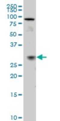 Western Blot: TGF beta induced factor 2 Antibody (5B11) [H00060436-M02]