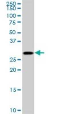 Western Blot: TGF beta induced factor 2 Antibody (5B11) [H00060436-M02]