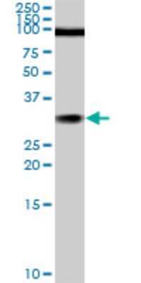 Western Blot: TGF beta induced factor 2 Antibody (5B11) [H00060436-M02]