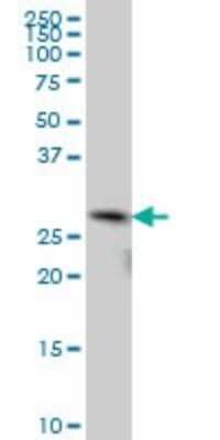 Western Blot: TGF beta induced factor 2 Antibody (5G1) [H00060436-M03]