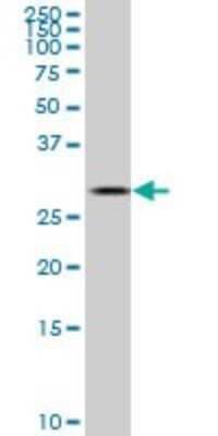 Western Blot: TGF beta induced factor 2 Antibody (5G1) [H00060436-M03]