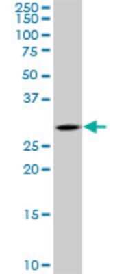 Western Blot: TGF beta induced factor 2 Antibody (5G1) [H00060436-M03]