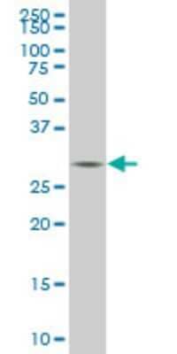 Western Blot: TGF beta induced factor 2 Antibody (6A8) [H00060436-M06]