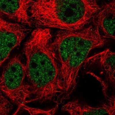 Immunocytochemistry/ Immunofluorescence: TGF beta induced factor 2 Antibody [NBP2-56813]