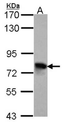 Western Blot: Beta Ig-h3/TGFBI Antibody [NBP2-20613]