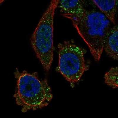 Immunocytochemistry/ Immunofluorescence: TGFBR3L Antibody [NBP2-57581]