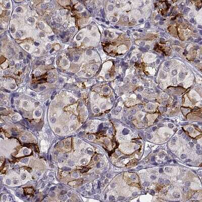 Immunohistochemistry-Paraffin: TGFBR3L Antibody [NBP2-57581]